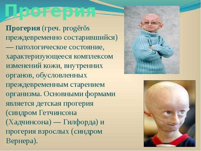 Жена пита бернса, дети. причина смерти и личная жизнь музыканта / певцы