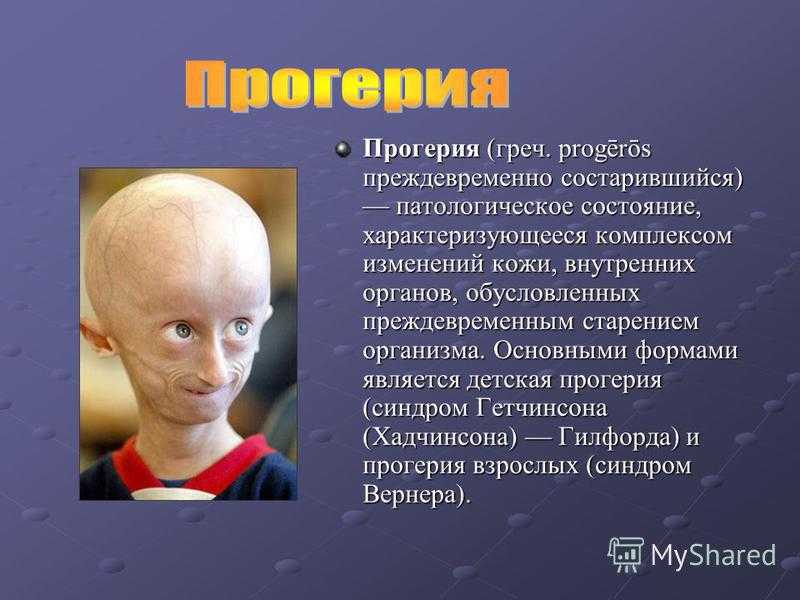 Самые редкие заболевания человека в мире | топ редких генетических заболеваний